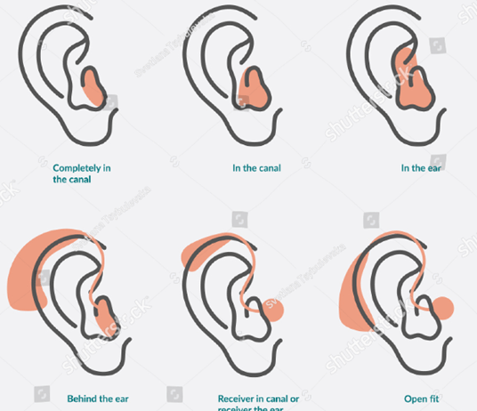 Hearing solution